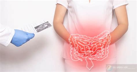 Whats The Difference Gut Health Test Vs Scopes Dr Ganesh Ramalingam