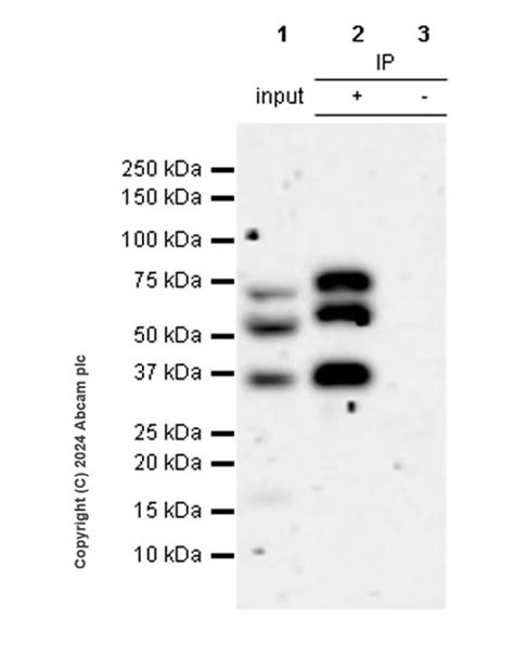 Anti Estrogen Receptor Alpha Mutated Y S D G Antibody Epr