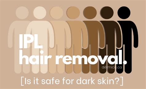 Is IPLHair Removal Safe for Dark Skin Tones?