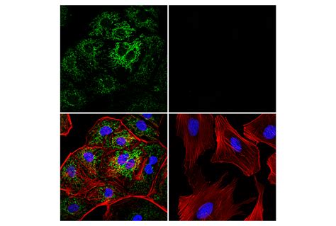 Mthfd2 E7a4l Xp® Rabbit Mab Alexa Fluor® 555 Conjugate Cell