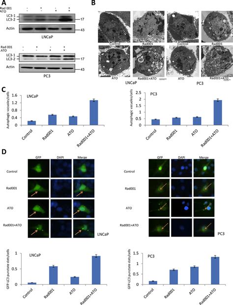 Rad And Ato Combination Synergistically Induced Autophagy In Lncap