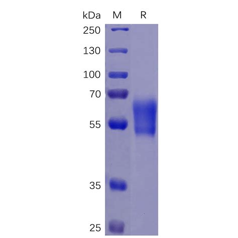 Human PD 1 Protein hFc His tag 专注肿瘤免疫