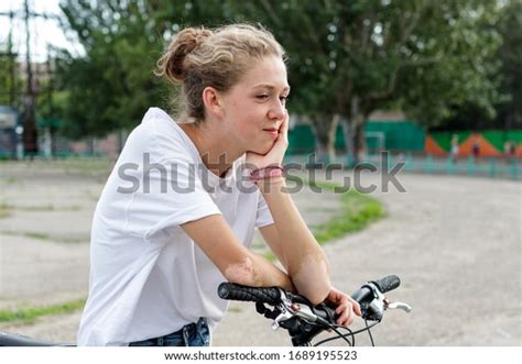 Wheel Skin Lesion Images Stock Photos Vectors Shutterstock