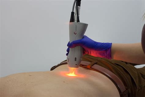 Laser Alexandrita Pro Clinica Lyzz