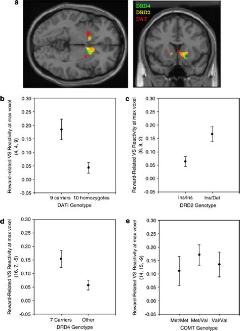 Overlay Of Statistical Parametric Maps For The Main Effects Of DAT1