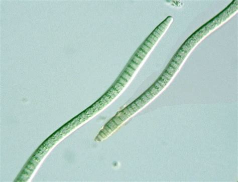 Prokaryote: Cyanobacteria: Oscillatoria priestleyi