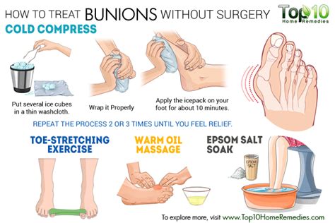 How To Treat Bunions Without Surgery Bunion Exercises Foot Exercises