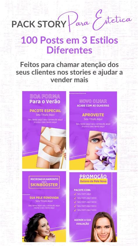 Pack Canva Estetica Para Story Feitos Para Chamar AtenÇÃo Do Seu