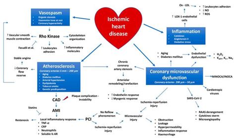 Ischemic Heart Disease Medizzy