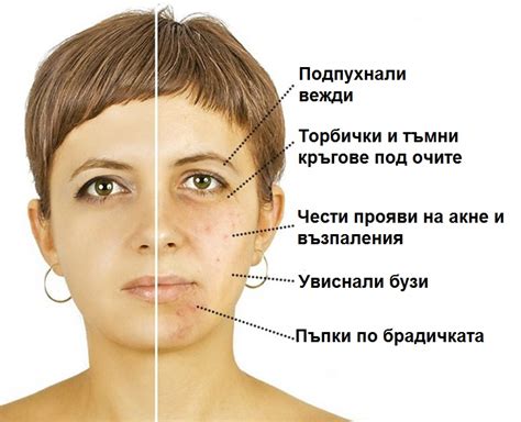 4 любими храни, които буквално обезобразяват женското лице! Вижте ...
