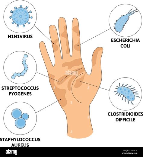 Washing hands viruses flat composition with human hand image surrounded ...