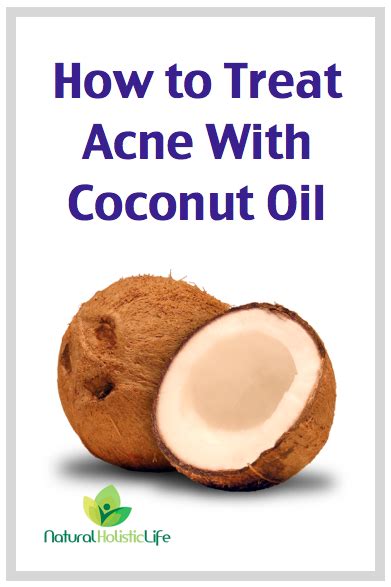 How To Treat Acne With Coconut Oil Natural Holistic Life