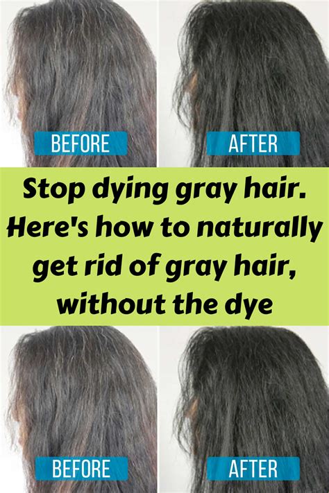 Stop Dying Gray Hair Here S How To Naturally Get Rid Of Gray Hair