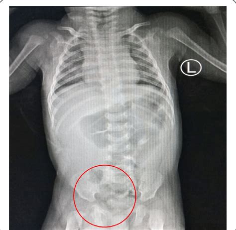 Plain abdominal radiography | Download Scientific Diagram