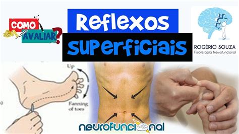 Como Avaliar Reflexos Superficiais Hoffmann Cut Neo Plantar E