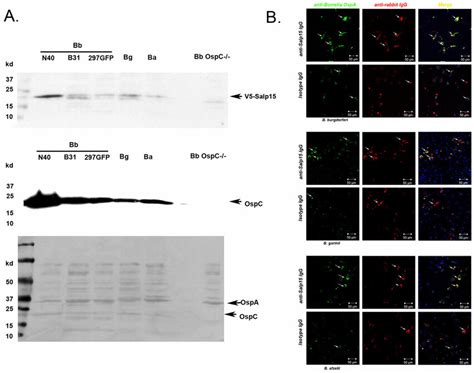 Salp15 antibodies enhance phagocytosis of different Borrelia species... | Download Scientific ...