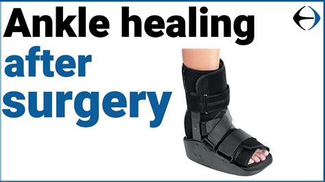 Ankle Surgery How Long Does It Take For Your Ankle To Heal After