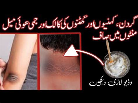 Neck Whitening Cream At Home Get Rid Of Drak Neck In Minutes Beauty