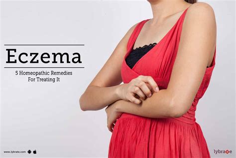 Eczema - 5 Best Homeopathic Remedies to Treat It - By Dr. Tarannum Shaikh | Lybrate