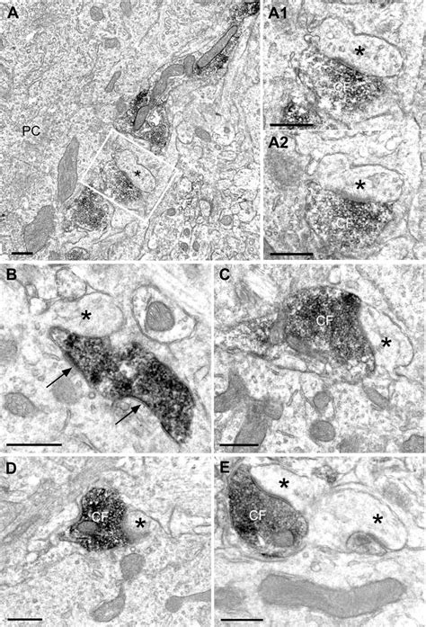 Vglut2 Positive Cf Terminals Establish True Synapses With Somatic