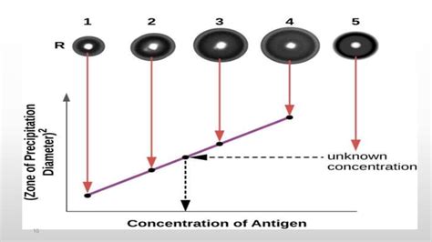 Single Radial Immunodiffusion Ppt