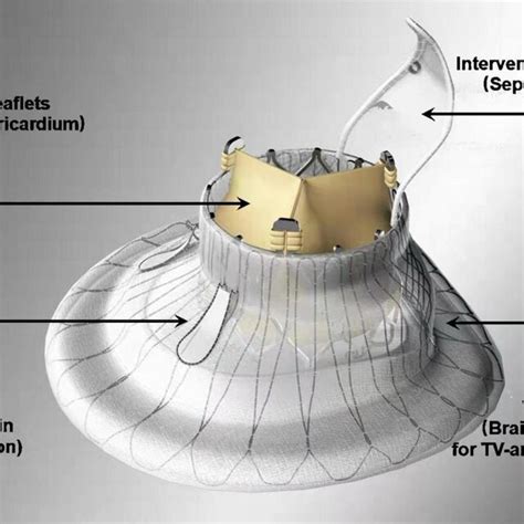 The Lux Valve The Lux Valve Has 4 Components 1 A Bovine Pericardium Download Scientific