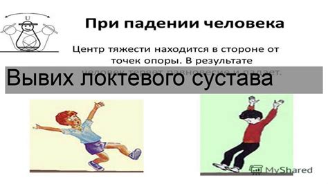Вывих локтевого сустава - YouTube