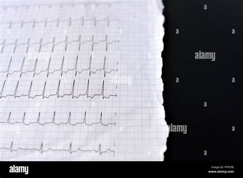 Electrocardiogram Ekg Hi Res Stock Photography And Images Alamy