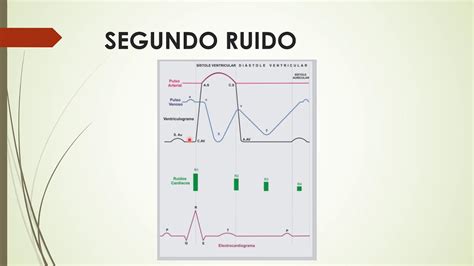 Ruidos Cardíacos Normales y Patológicos YouTube