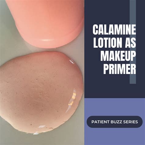 Patient Buzz Series Calamine Lotion As Makeup Primer Next Steps In