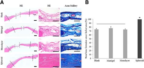 Histological Analysis Of Regenerated Bone After Implantation A