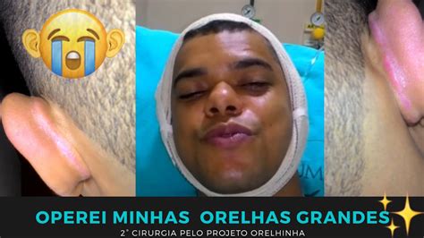 Otoplastia Projeto Orelhinha minha 1ª cirurgia e a 2ª cirurgia de