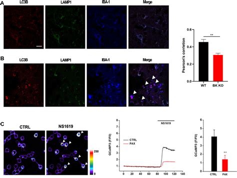 Frontiers Molecular Mechanisms Of Epileptic Encephalopathy Caused By