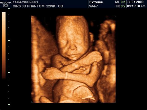 20 Week Ultrasound 4d Inrikoinspired