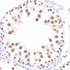 Anti Phospho C Myc S Antibody Produced In Rabbit