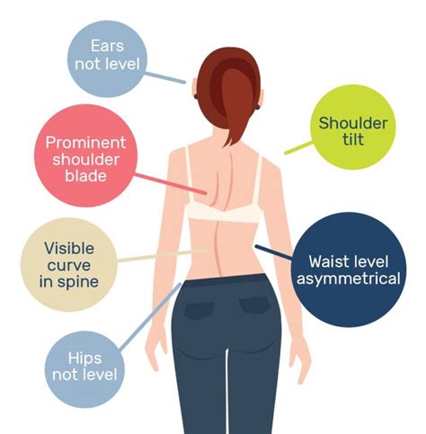 Scoliosis Exercises To Avoid Key Exercises That May Worsen Scoliosis