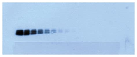 Thermo Scientific Supersignal West Pico Chemiluminescent Substrate