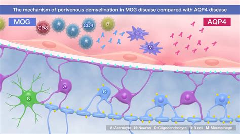 Myelin Oligodendrocyte Glycoprotein Antibody Associated Disease An