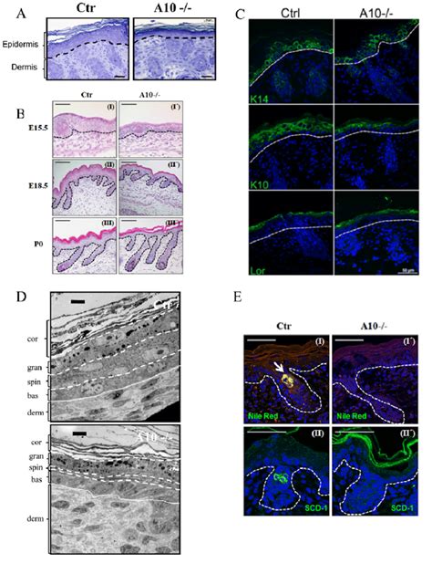 Histological And Ultrastructural Analysis Of Newborn Adam10 Deficient