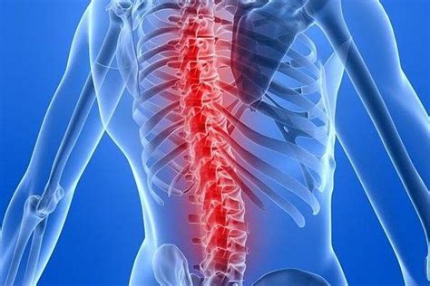 3 Things You Need to Know About Spinal Fusion Recovery | Rothman Orthopaedics