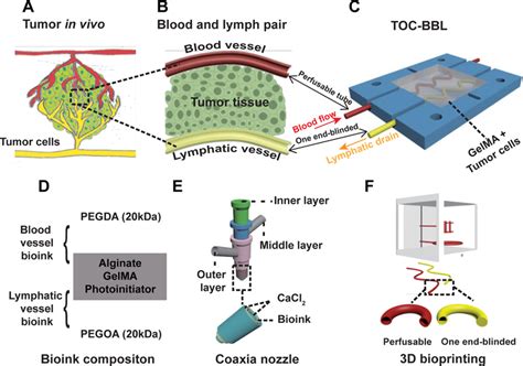 A Tumor On A Chip System With Bioprinted Blood And Lymphatic Vessel