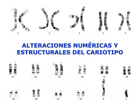 Alteraciones Numéricas Y Estructurales Del Cariotipo