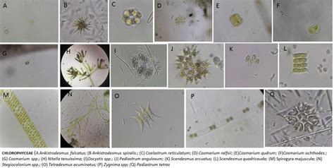 Microphotographic images of Cyanophyceae and Bacilariophyceae ...