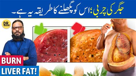 Jigar Ki Charbi Jalane Ke Betareen Foods Foods To Melt Fatty Liver