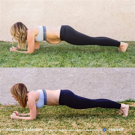 Behind the before after why this fitness coach got a mommy makeover