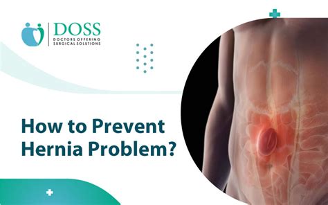 Effective Tips For Preventing A Hernia Doss India