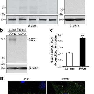 The Na Ca Exchanger Ncx Isoform Of Na Ca Exchanger