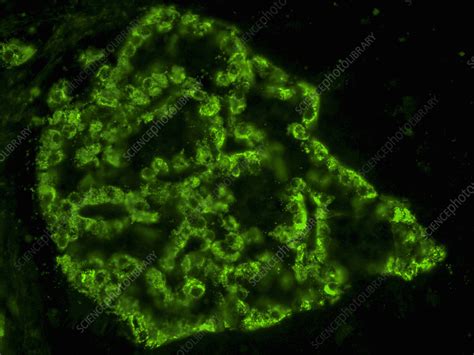 Pancreatic Islet Stained For A Cells Lm Stock Image C