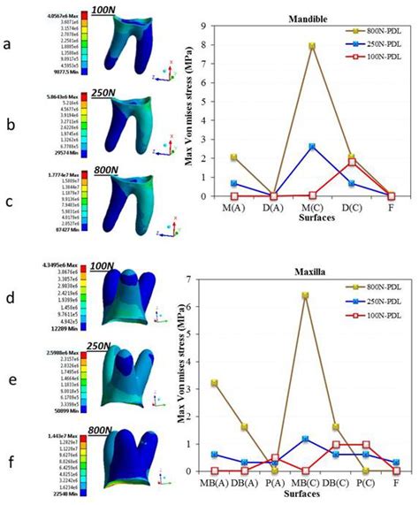 Von Mises Stress Distribution In The Pdl For The Six Models Figures A Download Scientific