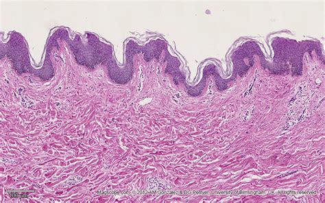 Stratified Squamous Epithelium Histology